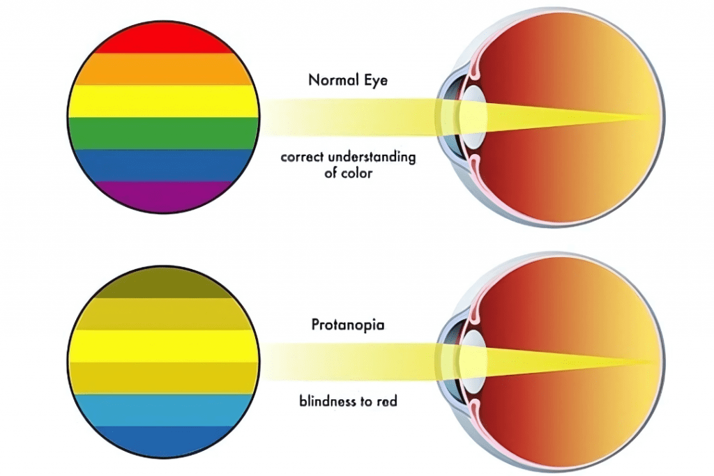 COLOUR BLINDNESS