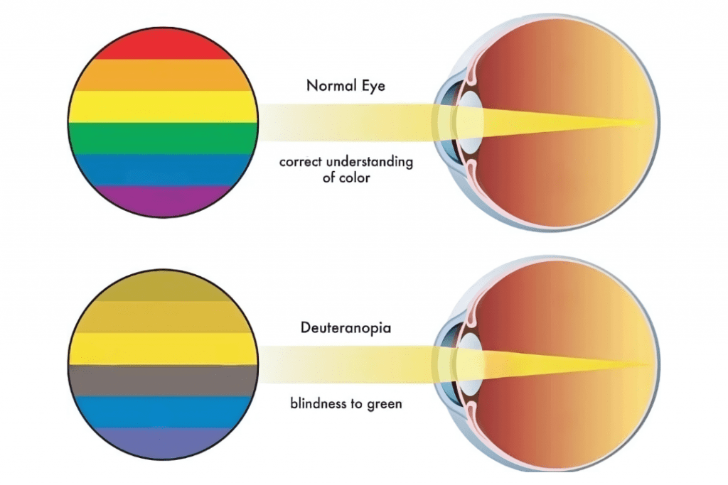 COLOUR BLINDNESS